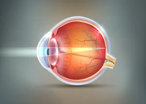 Clear Lens Extraction